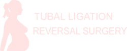 Tubal reversal surgery in Los Angeles - itubal